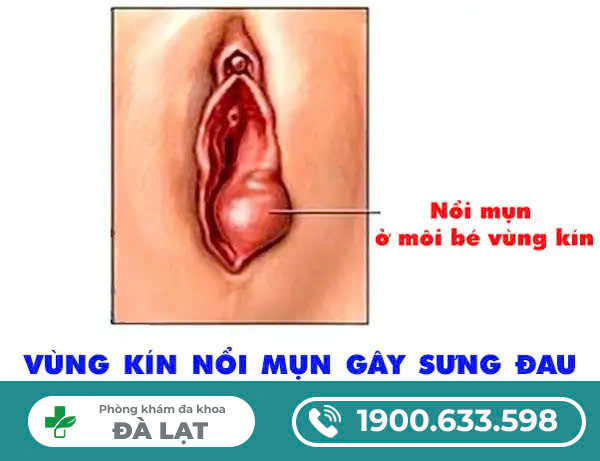 Hình ảnh minh họa